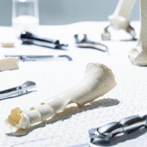 Jak długo goją się kości po wyjęciu śrub?